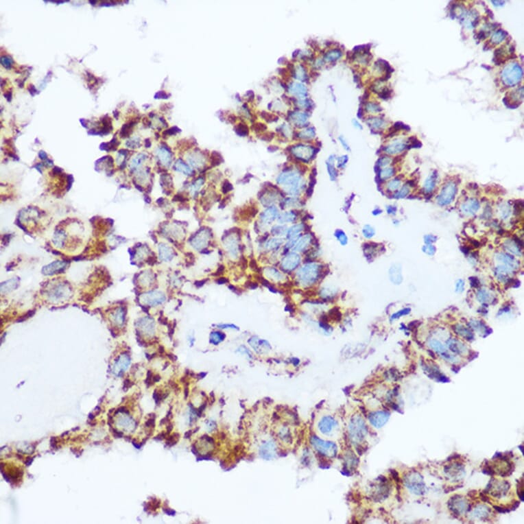 Immunohistochemistry - Anti-PDHA1 Antibody (A89894) - Antibodies.com