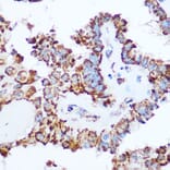 Immunohistochemistry - Anti-PDHA1 Antibody (A89894) - Antibodies.com