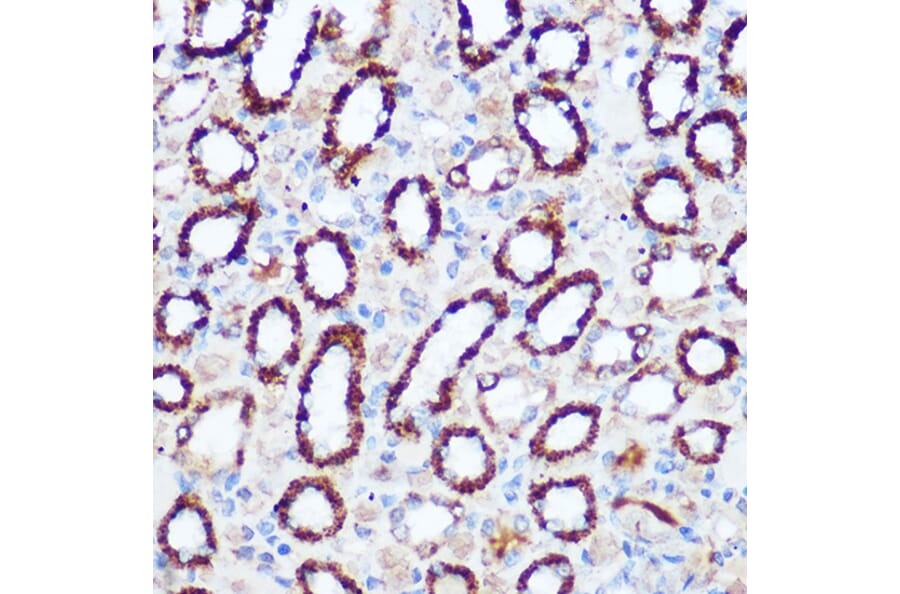 Immunohistochemistry - Anti-PDHA1 Antibody (A89894) - Antibodies.com