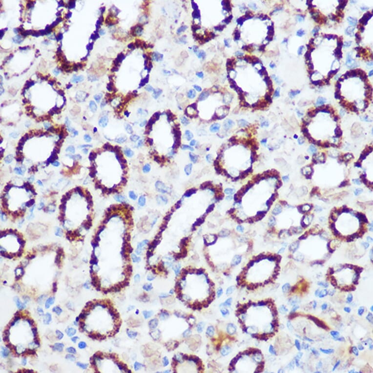 Immunohistochemistry - Anti-PDHA1 Antibody (A89894) - Antibodies.com