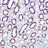 Immunohistochemistry - Anti-PDHA1 Antibody (A89894) - Antibodies.com