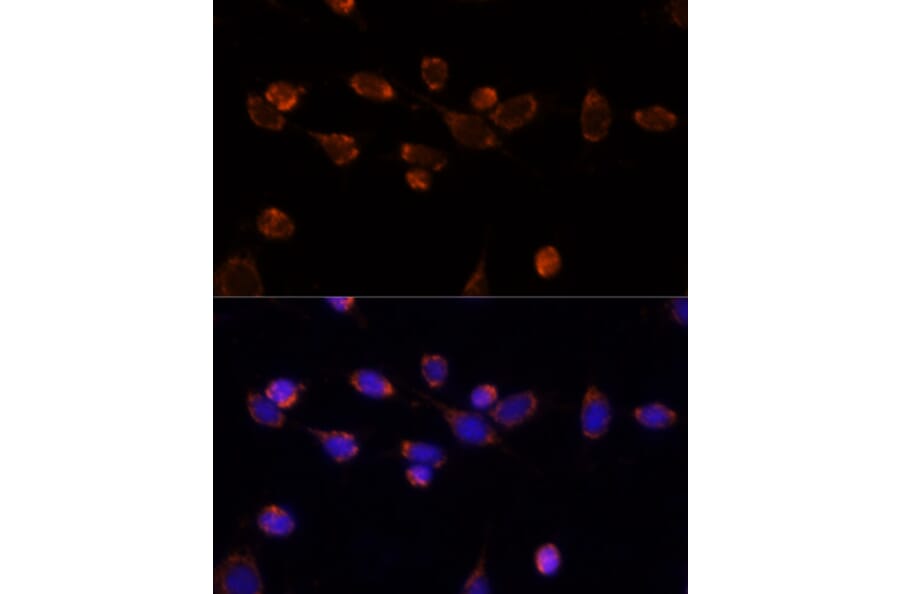 Immunofluorescence - Anti-PDHA1 Antibody (A89894) - Antibodies.com
