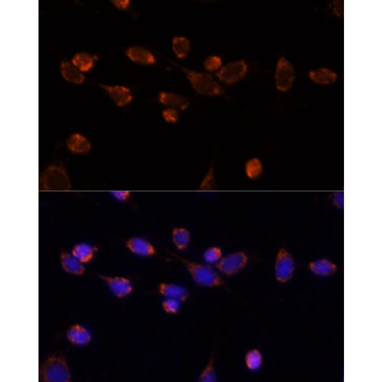 Immunofluorescence - Anti-PDHA1 Antibody (A89894) - Antibodies.com