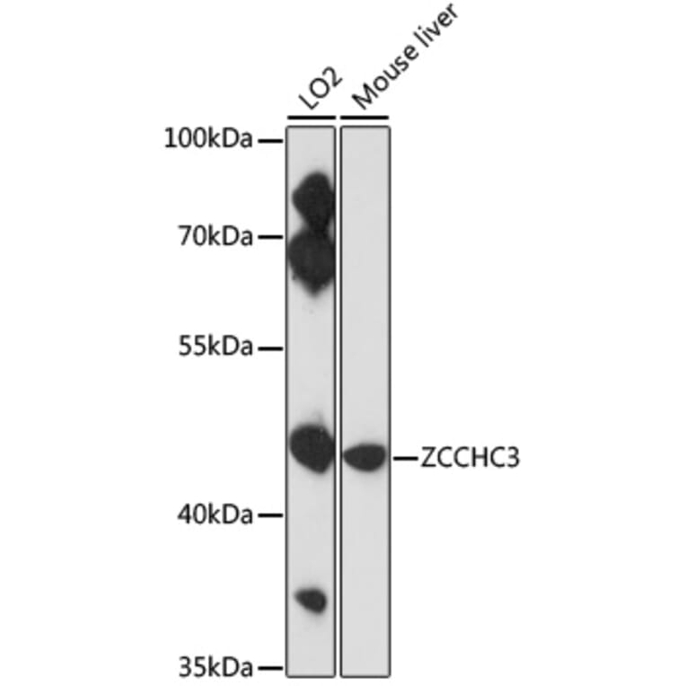Western Blot - Anti-ZCCHC3 Antibody (A89895) - Antibodies.com