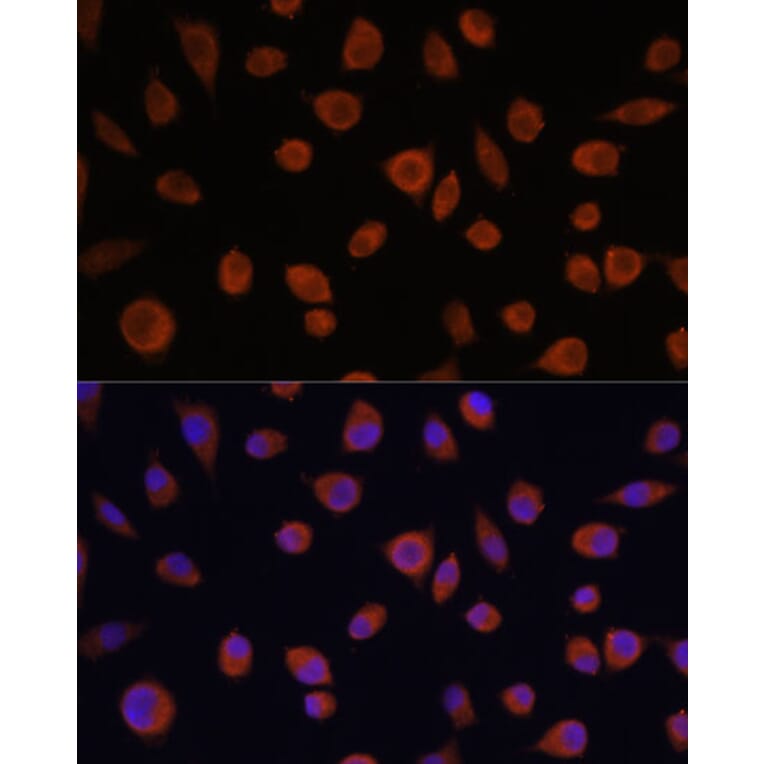 Immunofluorescence - Anti-ZCCHC3 Antibody (A89895) - Antibodies.com