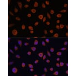 Immunofluorescence - Anti-ZCCHC3 Antibody (A89895) - Antibodies.com