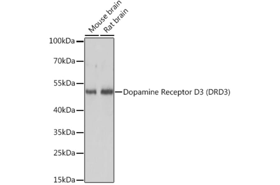 Western Blot - Anti-Dopamine Receptor D3/DRD3 Antibody (A89896) - Antibodies.com
