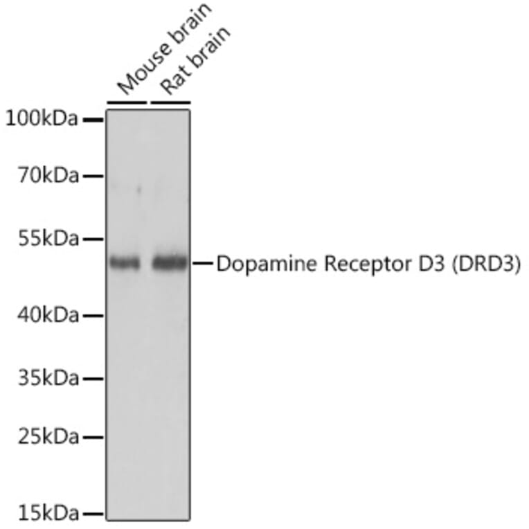 Western Blot - Anti-Dopamine Receptor D3/DRD3 Antibody (A89896) - Antibodies.com