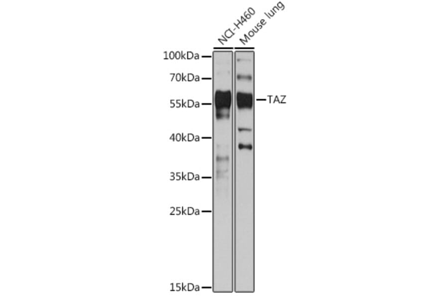 Western Blot - Anti-TAZ Antibody (A89897) - Antibodies.com