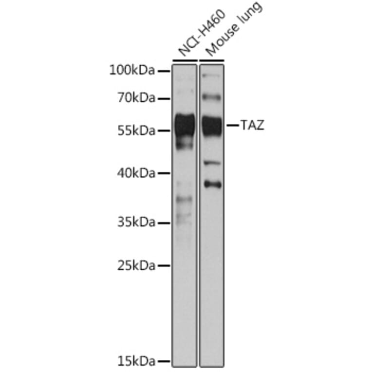 Western Blot - Anti-TAZ Antibody (A89897) - Antibodies.com