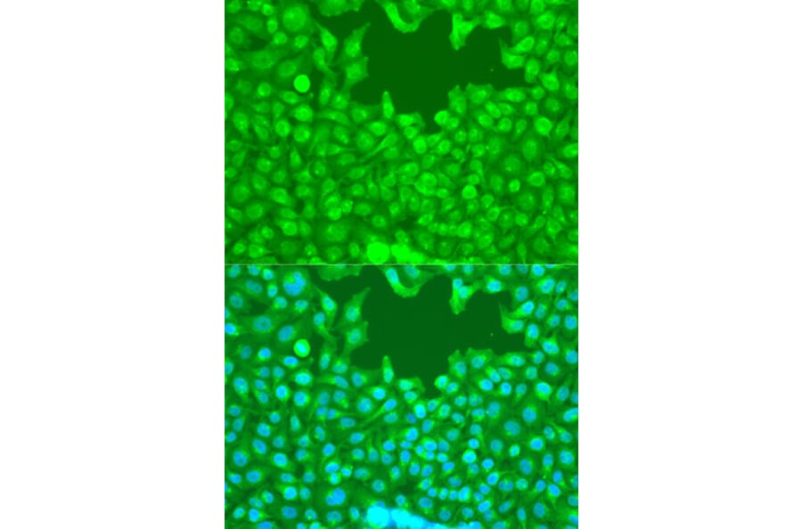 Immunofluorescence - Anti-TAZ Antibody (A89897) - Antibodies.com
