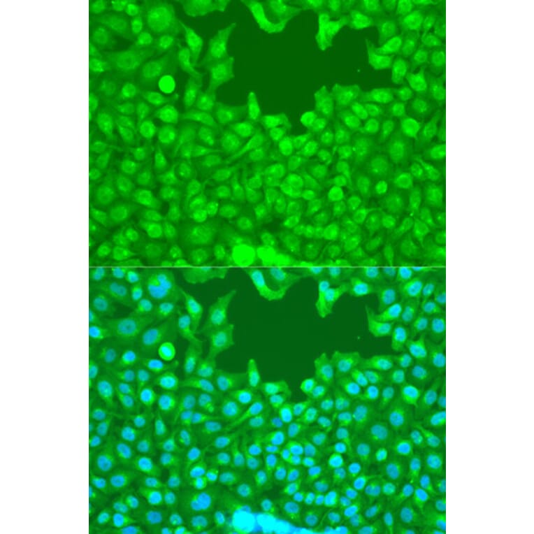 Immunofluorescence - Anti-TAZ Antibody (A89897) - Antibodies.com