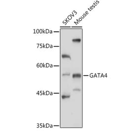 Western Blot - Anti-GATA4 Antibody (A89898) - Antibodies.com