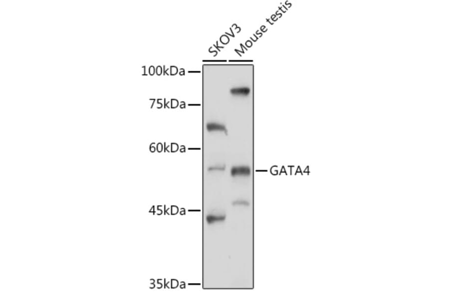 Western Blot - Anti-GATA4 Antibody (A89898) - Antibodies.com