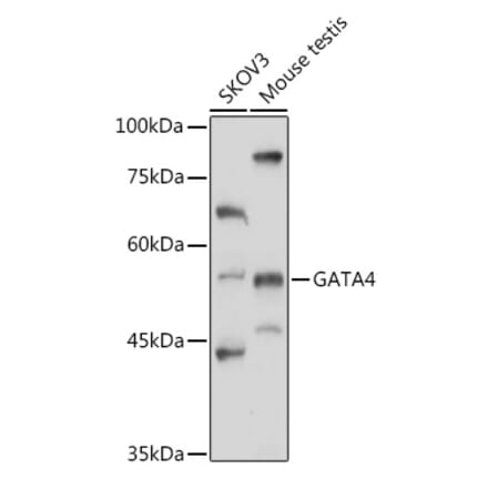 Western Blot - Anti-GATA4 Antibody (A89898) - Antibodies.com