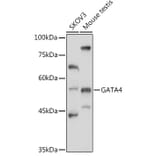 Western Blot - Anti-GATA4 Antibody (A89898) - Antibodies.com