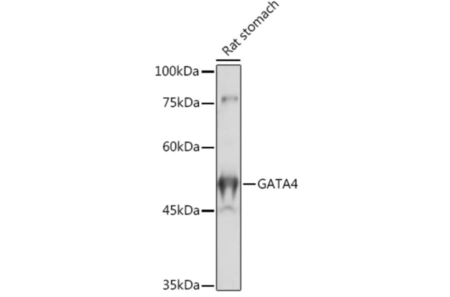 Western Blot - Anti-GATA4 Antibody (A89898) - Antibodies.com