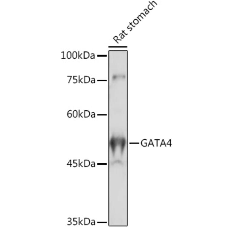 Western Blot - Anti-GATA4 Antibody (A89898) - Antibodies.com