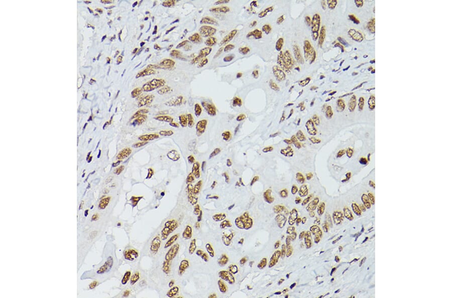 Immunohistochemistry - Anti-GATA4 Antibody (A89898) - Antibodies.com