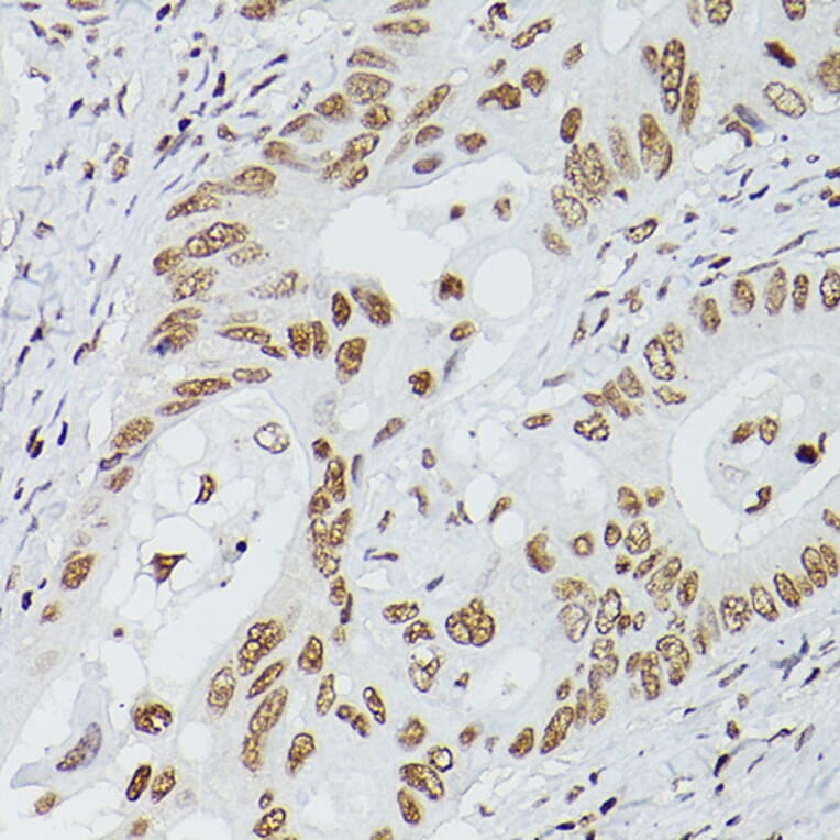 Immunohistochemistry - Anti-GATA4 Antibody (A89898) - Antibodies.com