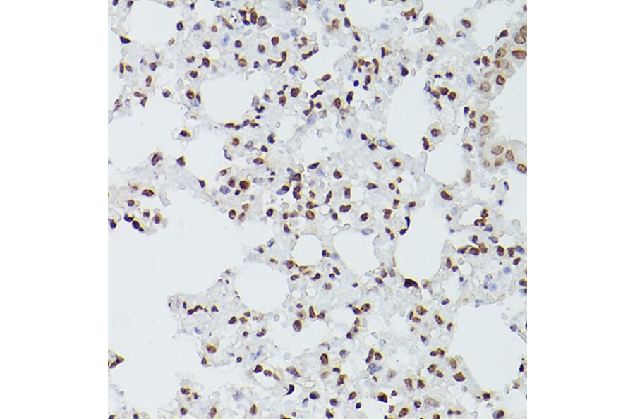 Immunohistochemistry - Anti-GATA4 Antibody (A89898) - Antibodies.com