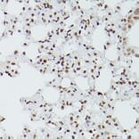 Immunohistochemistry - Anti-GATA4 Antibody (A89898) - Antibodies.com