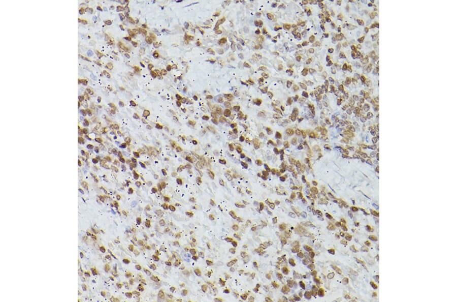 Immunohistochemistry - Anti-GATA4 Antibody (A89898) - Antibodies.com