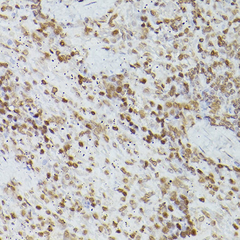 Immunohistochemistry - Anti-GATA4 Antibody (A89898) - Antibodies.com