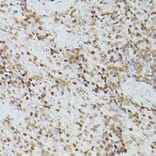 Immunohistochemistry - Anti-GATA4 Antibody (A89898) - Antibodies.com