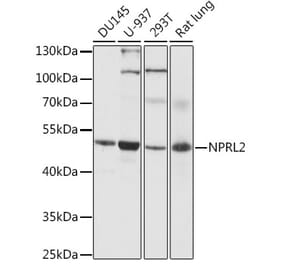 Western Blot - Anti-NPRL2 Antibody (A89899) - Antibodies.com