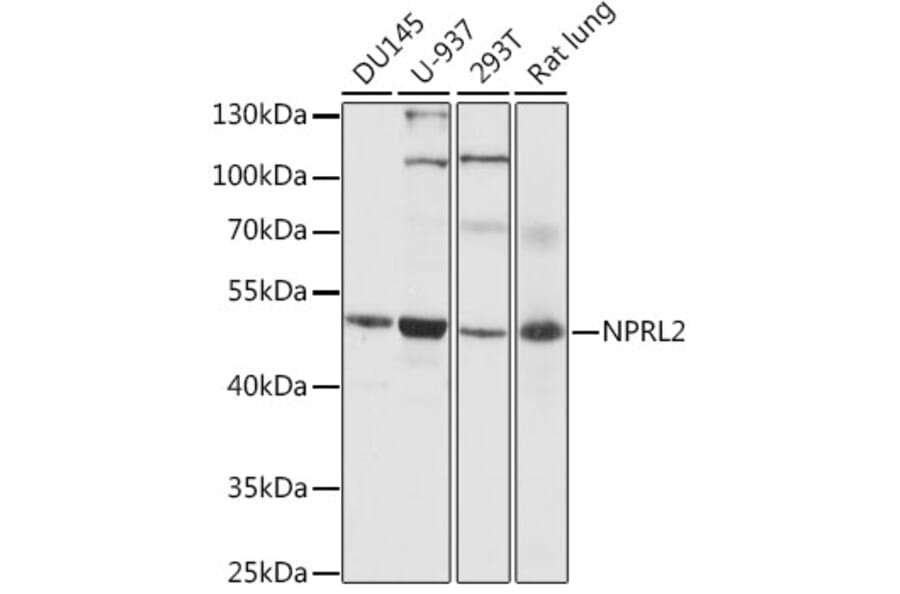 Western Blot - Anti-NPRL2 Antibody (A89899) - Antibodies.com