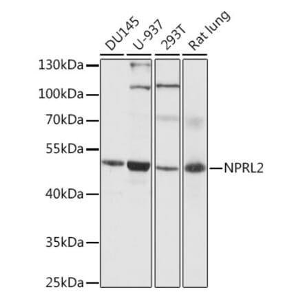 Western Blot - Anti-NPRL2 Antibody (A89899) - Antibodies.com