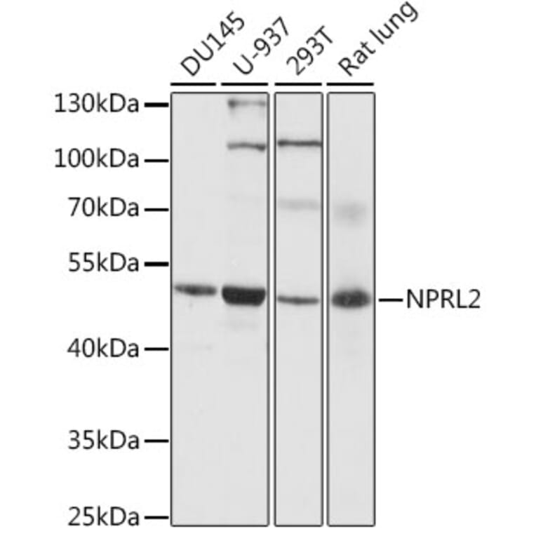 Western Blot - Anti-NPRL2 Antibody (A89899) - Antibodies.com