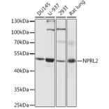 Western Blot - Anti-NPRL2 Antibody (A89899) - Antibodies.com