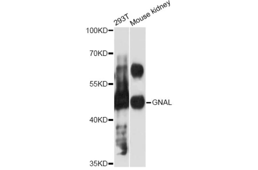 Western Blot - Anti-GNAL Antibody (A12804) - Antibodies.com