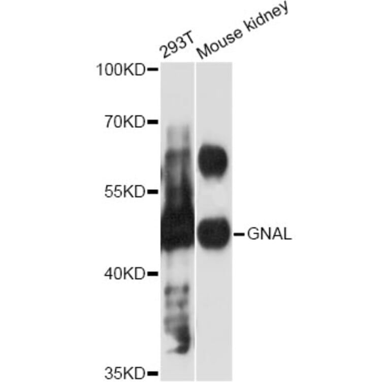 Western Blot - Anti-GNAL Antibody (A12804) - Antibodies.com