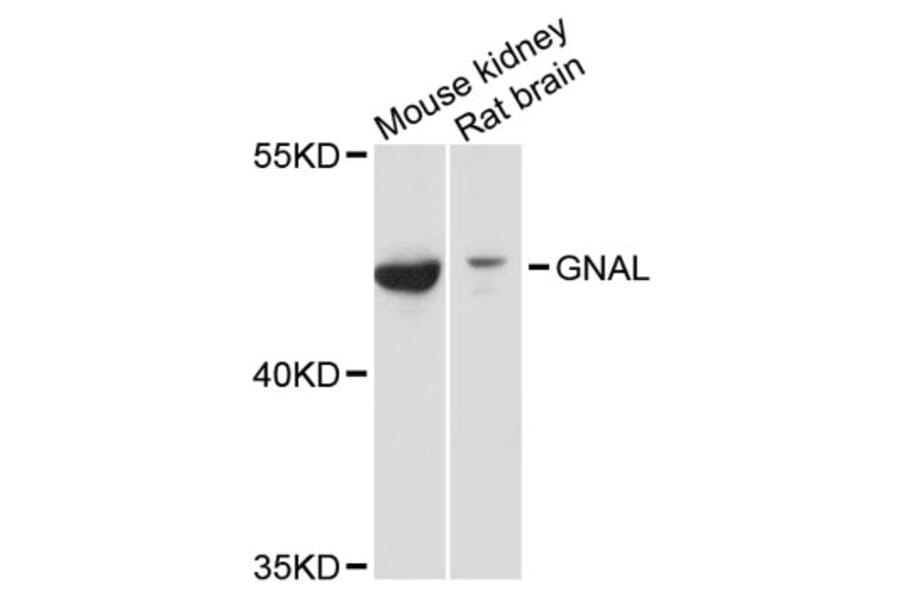 Western Blot - Anti-GNAL Antibody (A12868) - Antibodies.com