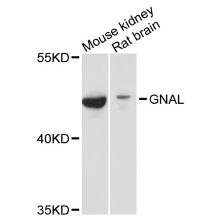 Western Blot - Anti-GNAL Antibody (A12868) - Antibodies.com