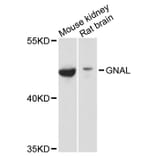 Western Blot - Anti-GNAL Antibody (A12868) - Antibodies.com
