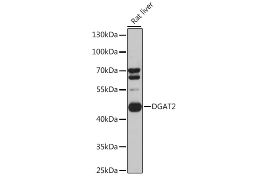 Western Blot - Anti-DGAT2 Antibody (A89902) - Antibodies.com