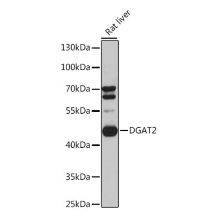 Western Blot - Anti-DGAT2 Antibody (A89902) - Antibodies.com