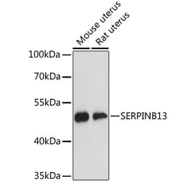 Western Blot - Anti-SERPINB13 Antibody (A89903) - Antibodies.com