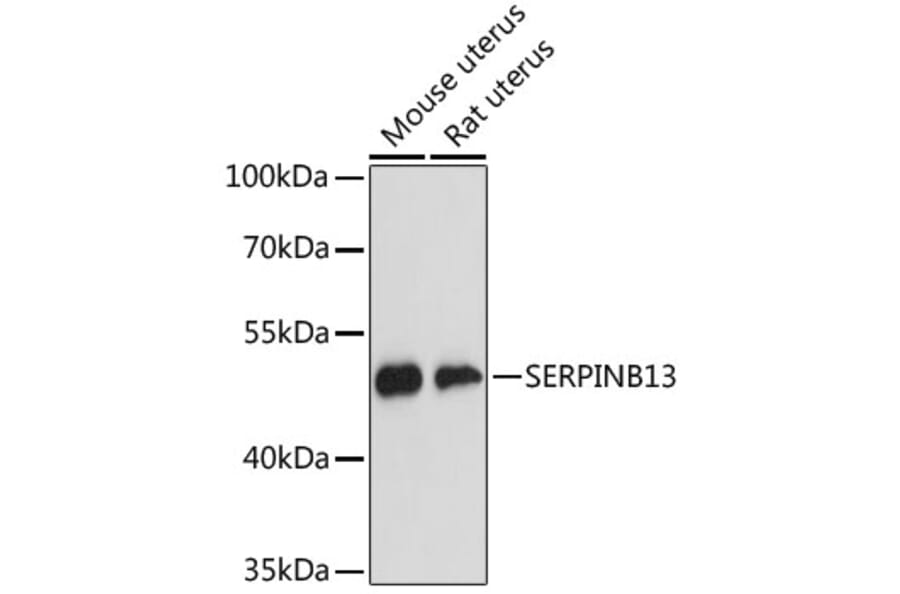 Western Blot - Anti-SERPINB13 Antibody (A89903) - Antibodies.com