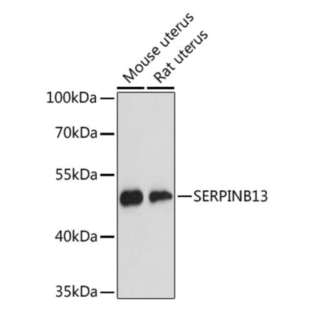 Western Blot - Anti-SERPINB13 Antibody (A89903) - Antibodies.com