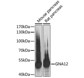 Western Blot - Anti-GNA12 Antibody (A89904) - Antibodies.com