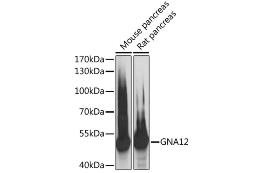 Western Blot - Anti-GNA12 Antibody (A89904) - Antibodies.com