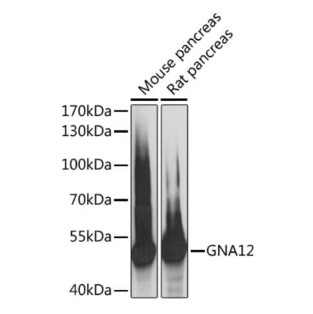 Western Blot - Anti-GNA12 Antibody (A89904) - Antibodies.com