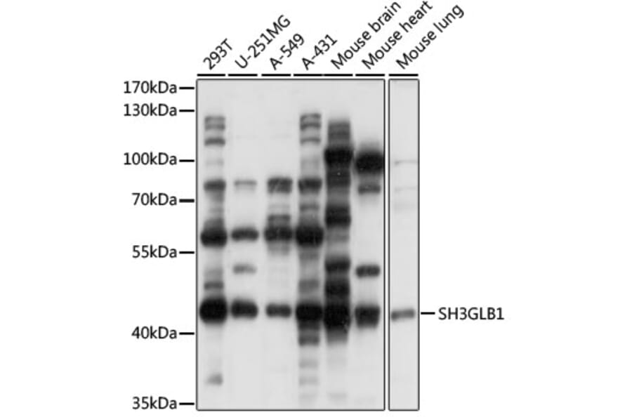 Western Blot - Anti-SH3GLB1 Antibody (A15158) - Antibodies.com