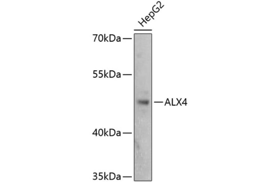 Western Blot - Anti-ALX4 Antibody (A89906) - Antibodies.com
