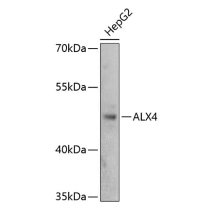 Western Blot - Anti-ALX4 Antibody (A89906) - Antibodies.com